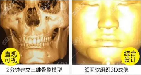 上海美聯(lián)臣<!--<i data=20240705-sp></i>-->下頜角修復(fù)優(yōu)勢(shì) 上海美聯(lián)臣<!--<i data=20240705-sp></i>-->下頜角修復(fù)優(yōu)勢(shì)