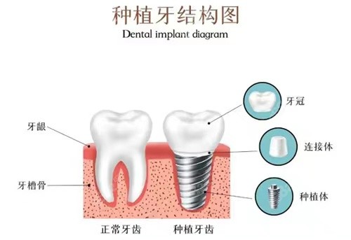 杭州东润口腔价格表参考