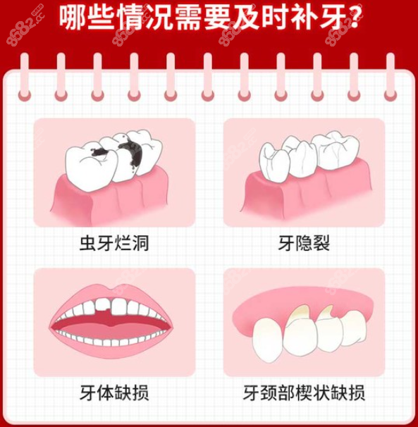 贵港哪家口腔医院补牙便宜