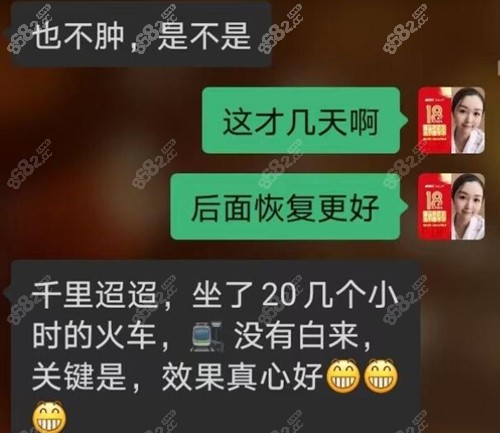 高亚东拉皮口碑评价参考