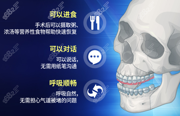 韩国id突嘴双鄂手术优势