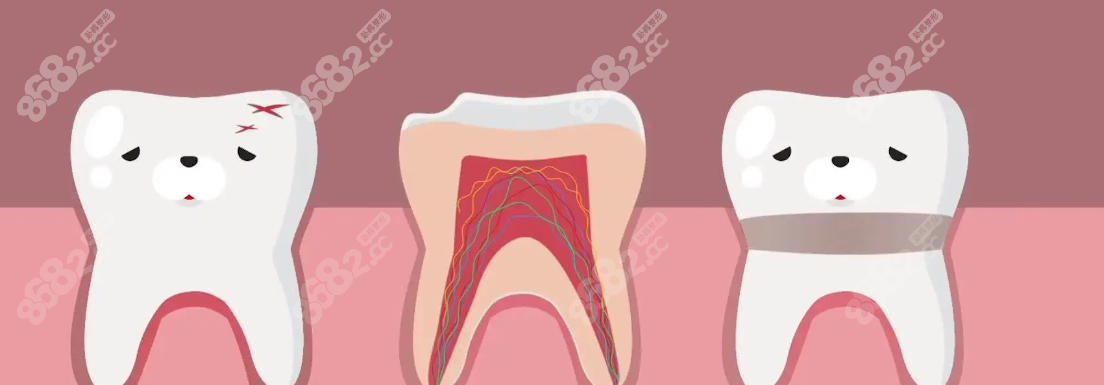 牙齿损伤造成神经外露
