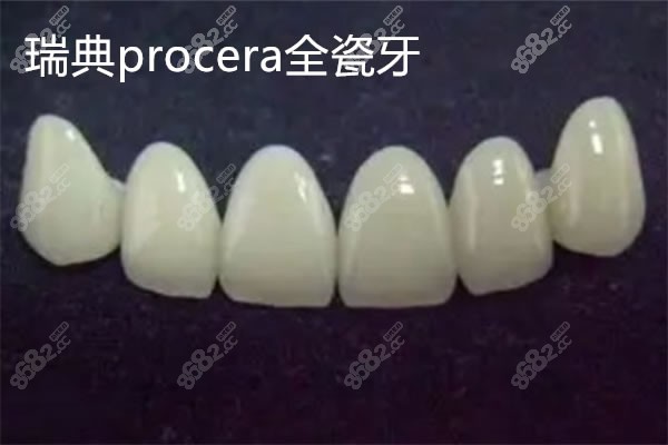 瑞典procera全瓷牙