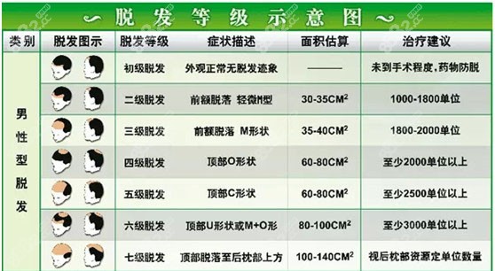 脫發(fā)程度圖 脫發(fā)程度圖