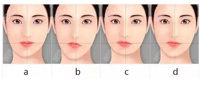 面部不对称脸歪的原因及矫正方法