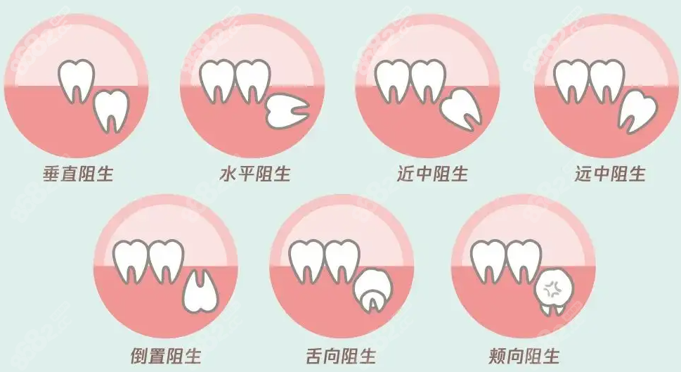 江津拔智齿费用多少钱