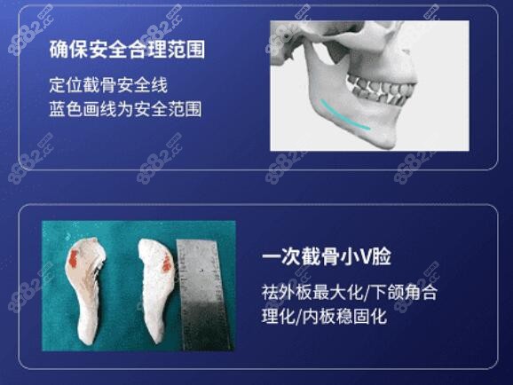 刘正茂做轮廓做的怎么样？