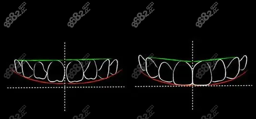 牙齿的美学曲线