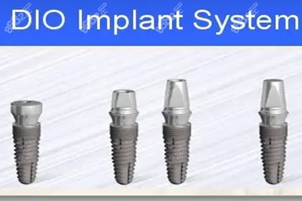 韩国DIO种植体