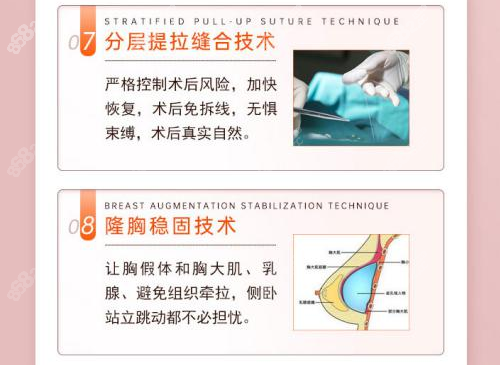 黄名斗隆胸优势详解