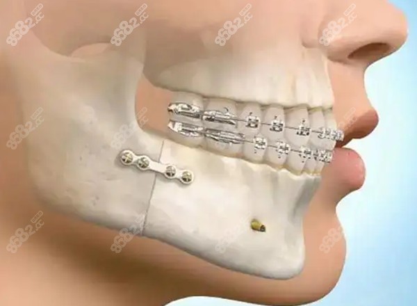 一个牙医的良心忠告整牙