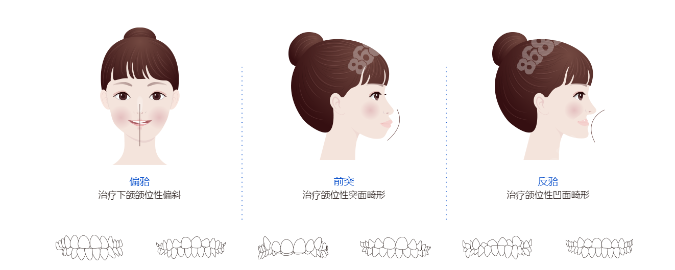 航天版可以改善