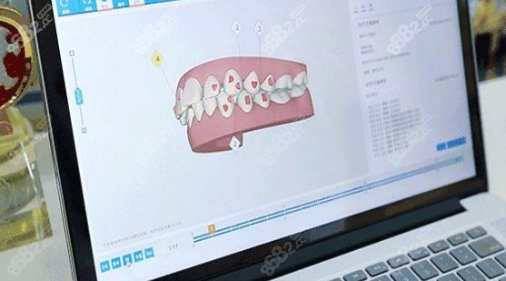 番禺博德美加口腔矫正牙齿特色