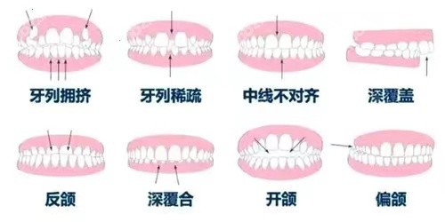北京朗瑞口腔牙齿矫正技术怎么样