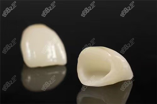 做了全瓷牙冷热敏感多久能好
