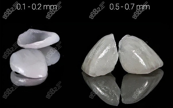 瓷贴面0.2mm和0.5mm对比