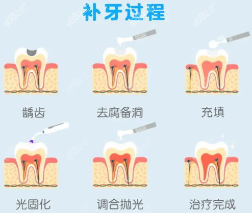 六盘水牙科整牙贵吗