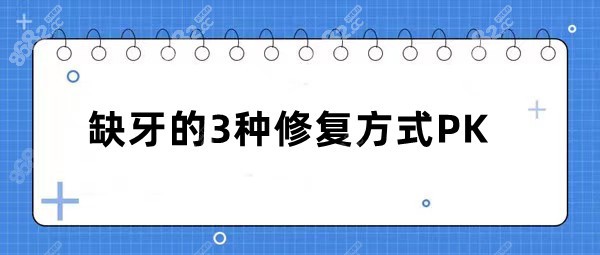 缺牙治疗方式有3种：活动假牙、搭桥和种植牙哪个好~PKK