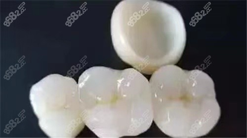 全瓷牙来进行牙齿修复能更好些