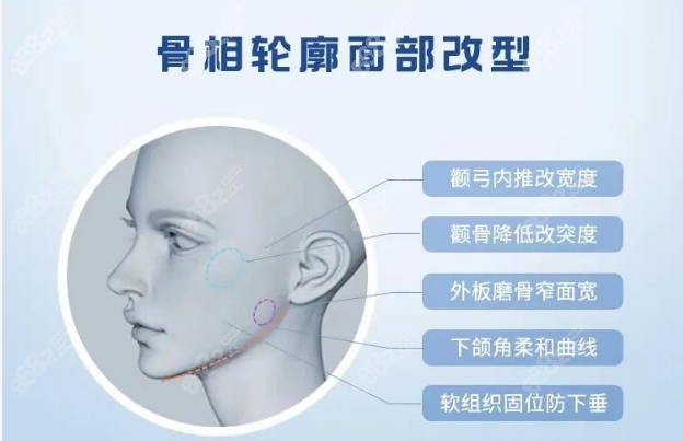 重庆星荣刘正茂做下颌角怎么样