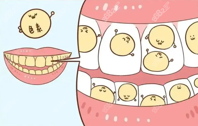 南昌牙贴面可以改善牙黄