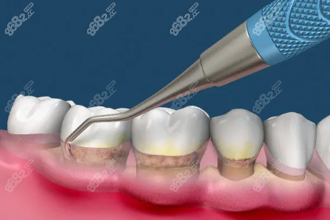 三门峡牙科收费标准www.8682.cc
