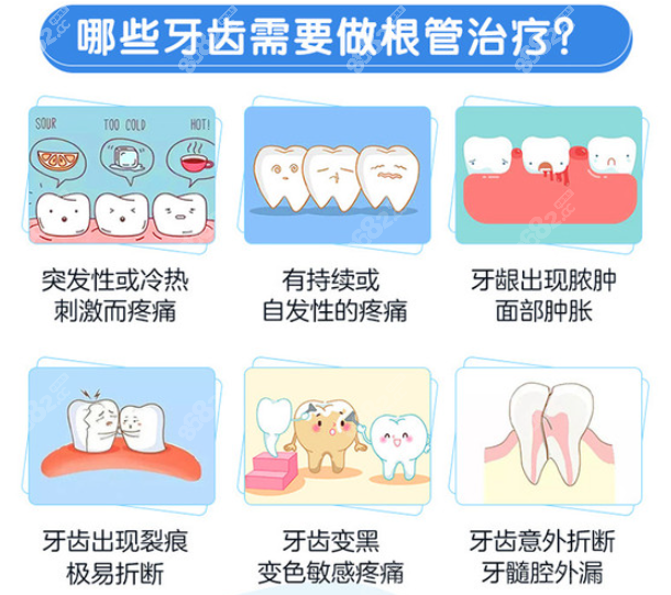 柳州根管治疗哪里好又实惠