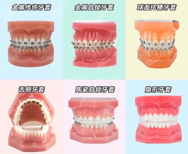 上海维佳康口腔牙齿矫正怎么样