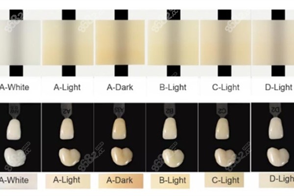 procera睿典瓷牙冠6种颜色