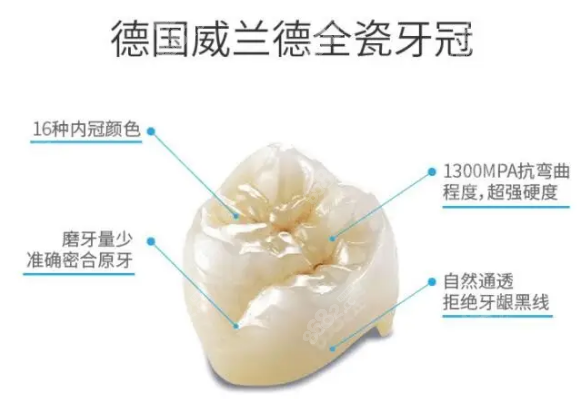 威兰德全瓷牙多少钱一颗价格表2022