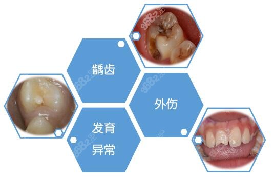 小孩根尖诱导有必要弄吗