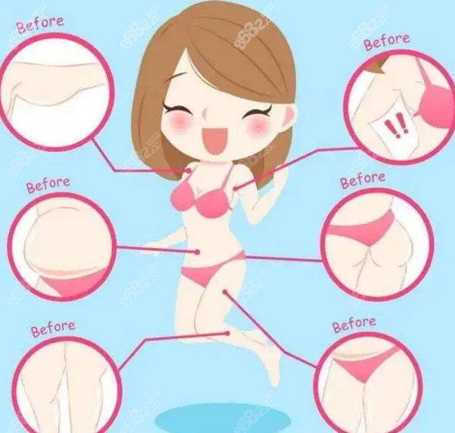 长沙大腿吸脂手术价格