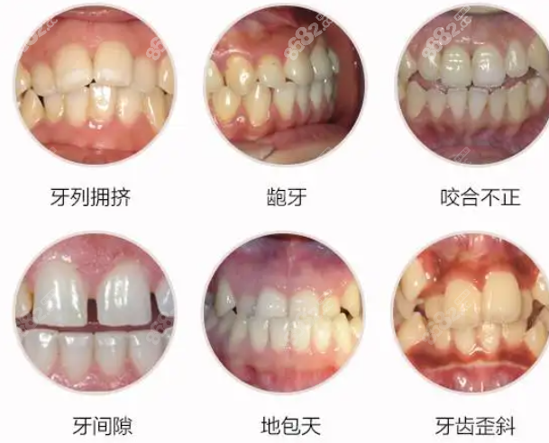 株洲新南光口腔牙齿矫正收费