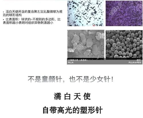 濡白天使注射能填充几个部位.jpg