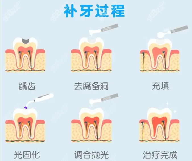 深圳德贝美景龙口腔门诊部开业钜惠,德国种植牙3980元起/颗