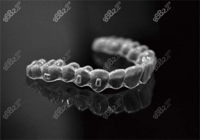 可丽尔隐形牙套 可丽尔隐形牙套