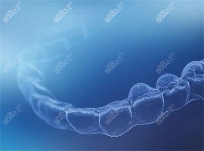 时代天使隐形牙套的特点及优势2 时代天使隐形牙套的特点及优势2