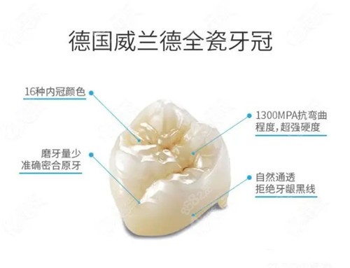 德国威兰德全瓷牙优势