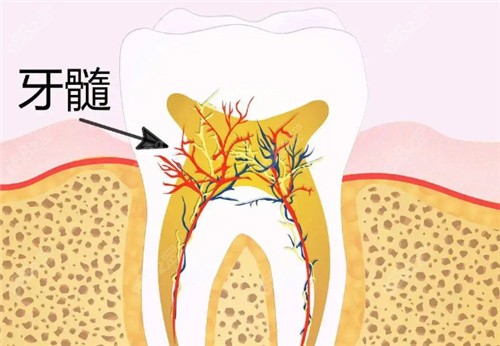 牙神经坏了能修复吗