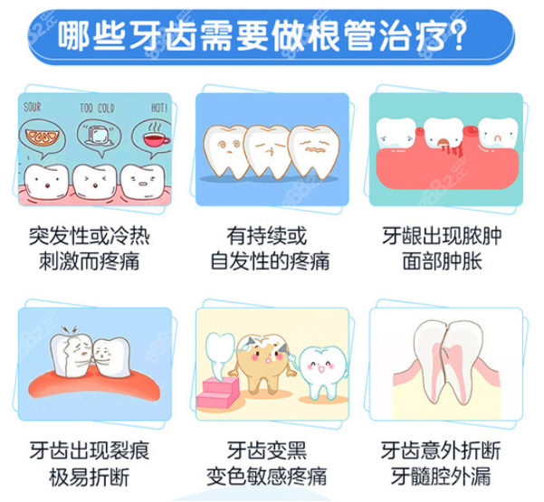 牙齿有洞但是不疼需要根管治疗吗