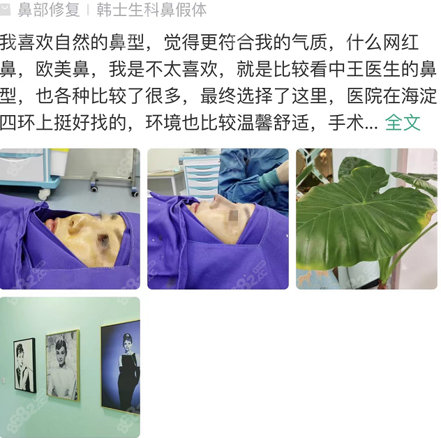 北京泛美医疗美容整形医院的王军医生鼻整形好评