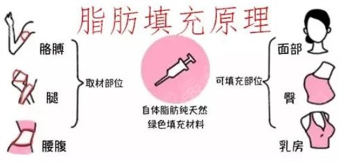 崔昌墉做自体脂肪填充很擅长