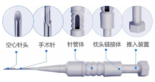 大麦微针的pse微针植发技术