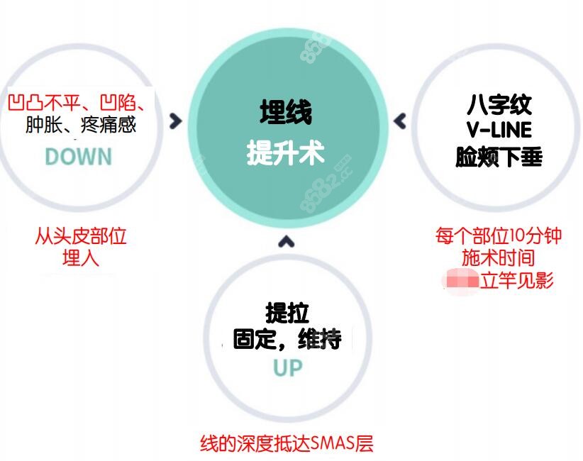 韩国faceplus整形是韩国埋线提升好的推荐医院