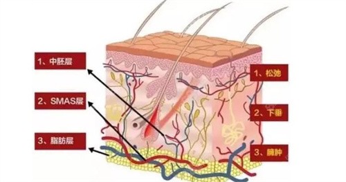 皮肤层分解示意图