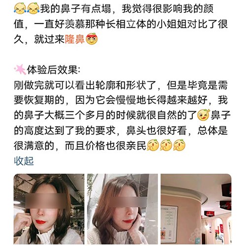广州美莱隆鼻评价
