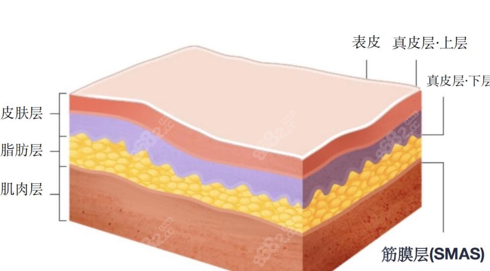 拉皮和面部提升哪个更好一点