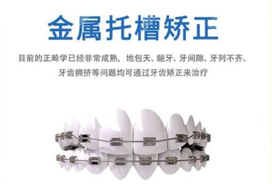 更新衡阳美莱口腔牙齿矫正收费标准