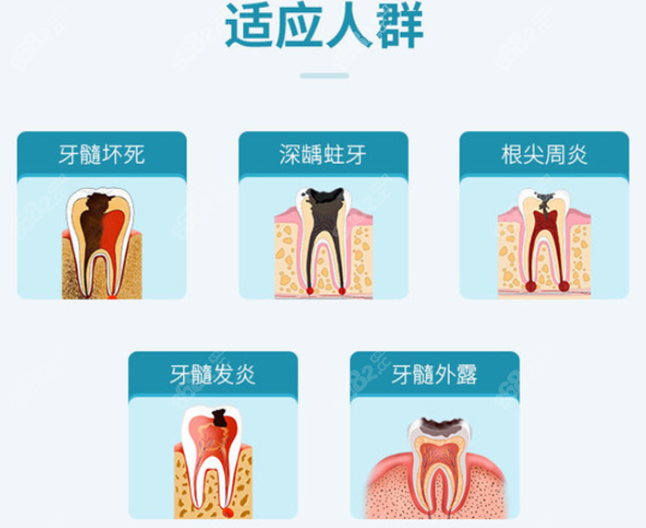 20岁根管治疗后牙齿能用多久