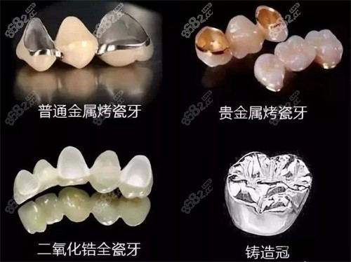 全瓷牙
